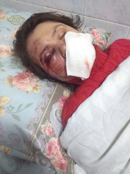 В Украине начали избивать активистов Евромайдана 