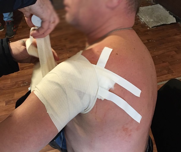 Врачи оказывают помощь раненному в КПП Майорск. Фото – Госпогранслужба Украины