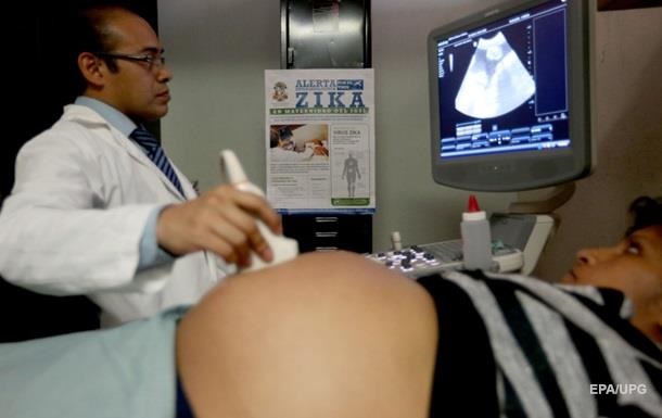 Вирус Зика обнаружили почти у 400 беременных в США