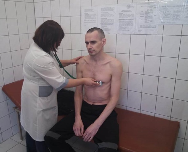 Появилось фото украинского режиссера Олега Сенцова из больницы