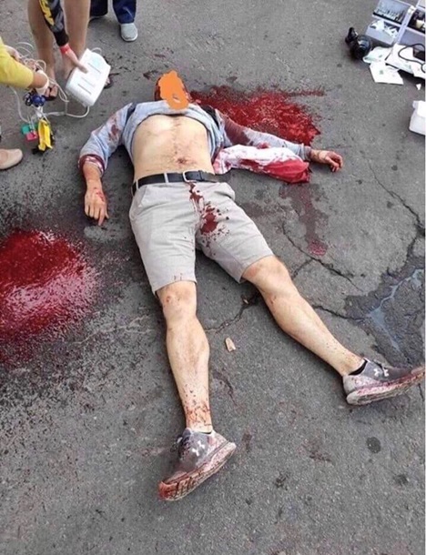 На Киевщине журналисту перерезали сонную артерию