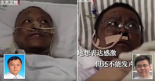 У заразившихся COVID-19 врачей в Китае потемнела кожа 