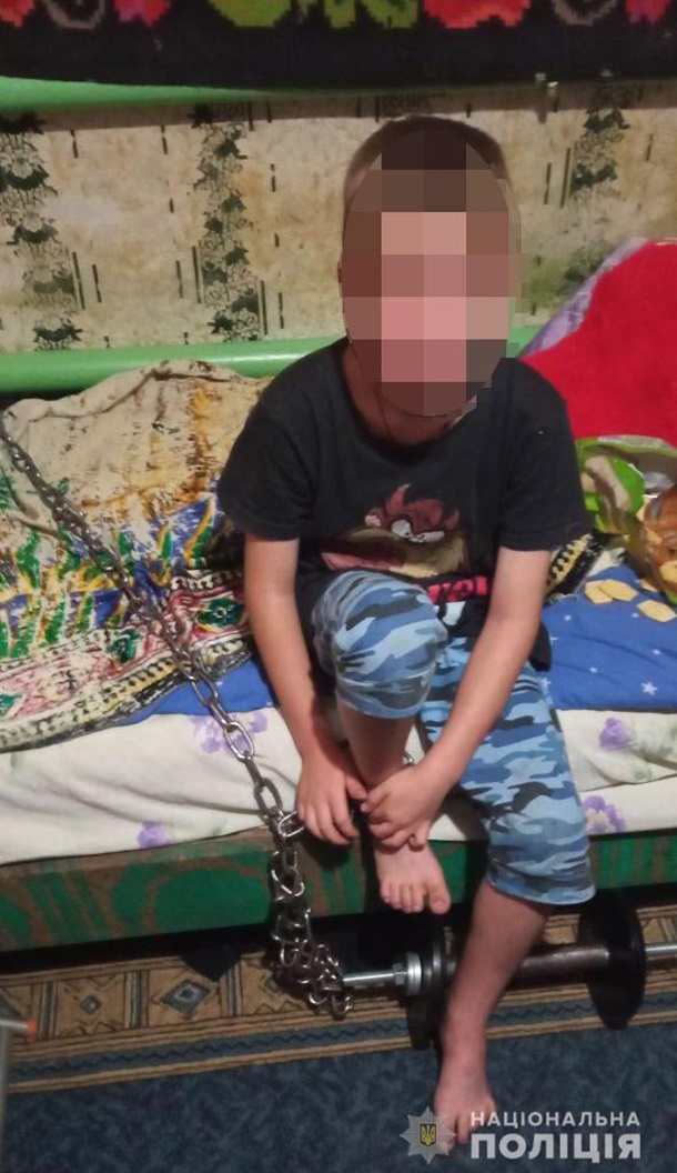 В Кривом Роге 7-летнего мальчика держали на цепи