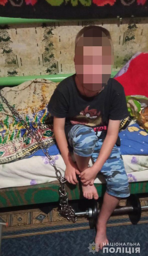 В Кривом Роге 7-летнего мальчика держали на цепи В Кривом Роге 7-летнего мальчика держали на цепи