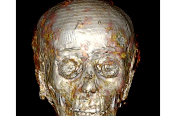 В Египте исследовали мумию «золотого мальчика»