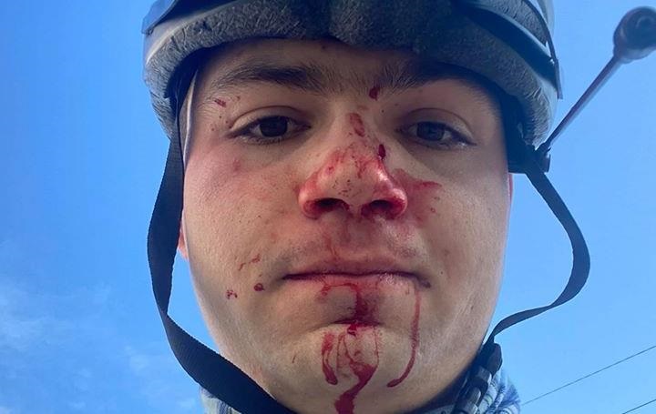 В Киеве избили велосипедиста, помешавшего машине проехать по ...
