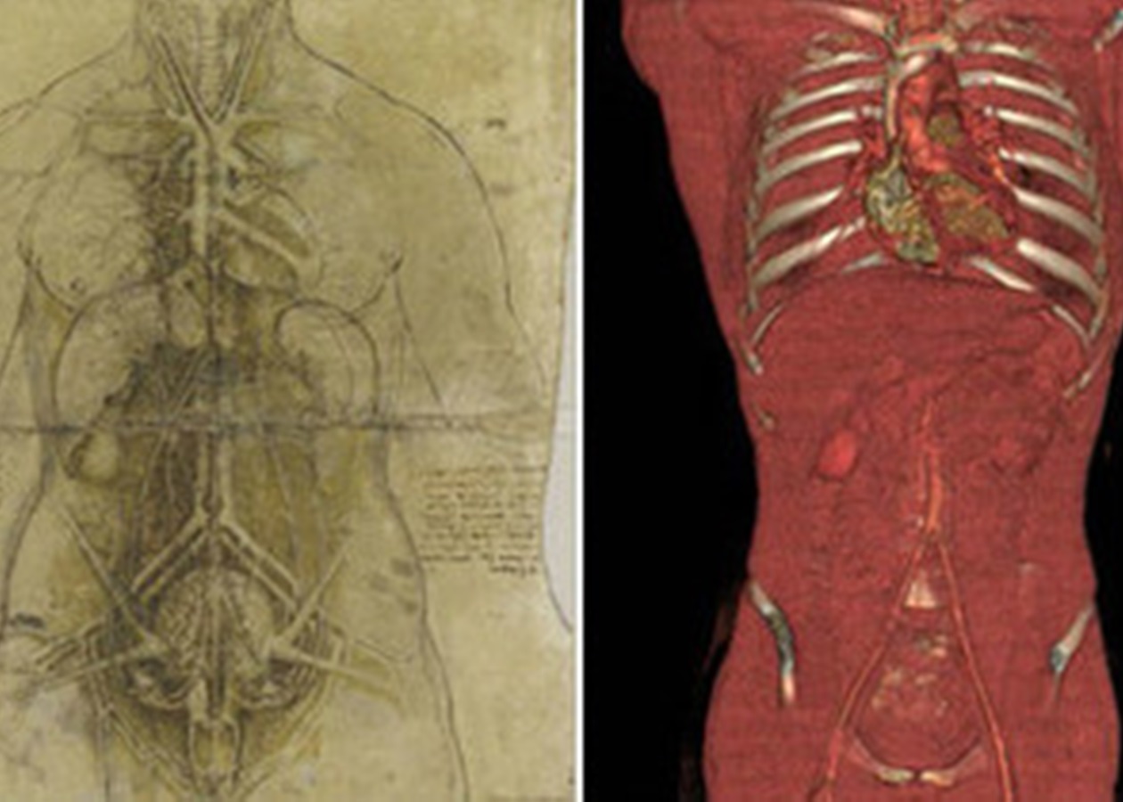 Насколько точны анатомические рисунки Леонардо да Винчи? - Korrespondent.net