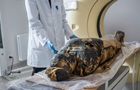 Ученые раскрыли еще один секрет первой в мире беременной мумии