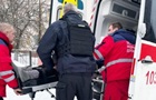 На Чернігівщині під обстріл потрапила родина, поранено дитину