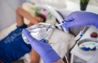 Вже понад 60 хворих: у Києві шукають джерело спалаху гепатиту А