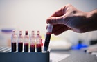 Відомо, скільки випадків ВІЛ-інфекції зафіксували в Україні з початку року
