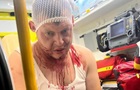 У Польщі стався черговий напад на українців