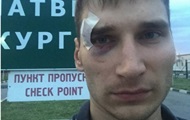 Сепаратисты избили российского журналиста и выпроводили в РФ
