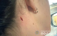 В Николаеве женщина пострадала во время полицейских стрельб