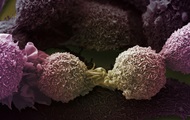 Найдены мутации, вызывающие рак легких