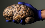 Ученые узнали, как победить старение мозга