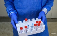На Волыни четыре сотрудницы лаборатории заболели COVID-19