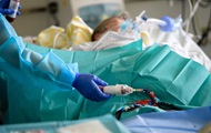 Тяжелый COVID удваивает шанс умереть в течение года ученые