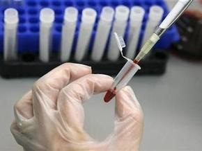 Ученые научились блокировать вирусы СПИДа