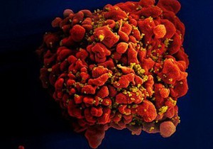 Новини науки - новини медицини: Медики недооцінили  сплячі резерви  ВІЛ у 60 разів