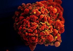 Новости науки - новости медицины: Медики недооценили  спящие резервы  ВИЧ в 60 раз