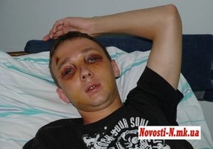 В милиции признали, что ее сотрудник причастен к жестокому избиению студента в Николаеве