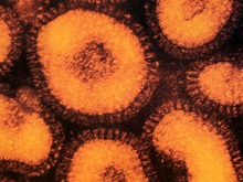 Ученые: Иммунитет к вирусу гриппа сохраняется почти 100 лет