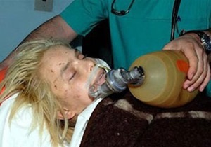 Прокуратура: Аппарат искусственного дыхания не мог разорвать легкие Оксаны Макар