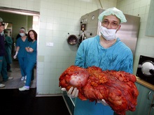 Китайские хирурги удалили самую большую опухоль в мире