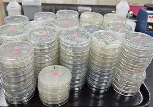 Новости науки - бактерии - генетика: Ученые научились читать геном бактерий по ДНК из единственной клетки