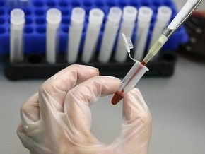 В Македонии подтверждены первые случаи гриппа A/H1N1