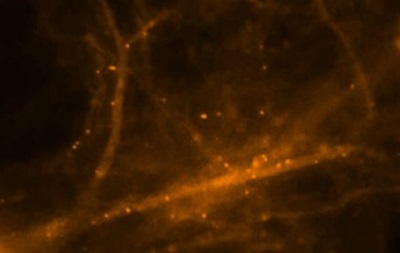 Вчені зняли на відео процес формування спогадів у нейронах