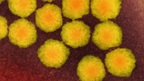 У США виявили хворих з вірусом, "схожим на поліомієліт"