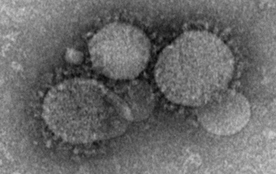 У Греції виявлено випадок зараження небезпечним коронавірусом MERS