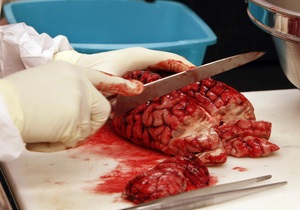 Ученые: Обезвоживание мозга мешает ориентироваться в пространстве