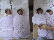 В США родились четверо редких близнецов