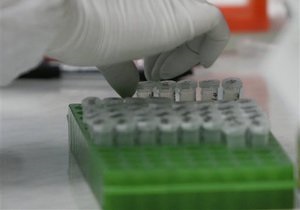 Американские ученые нашли причины природного иммунитета к ВИЧ