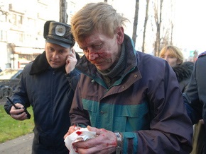 КУН: Националисты, облившие краской памятник Ленину, госпитализированы с многочисленными переломами