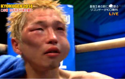 Кубинський чемпіон побив японця до невпізнання і зламав йому щелепу