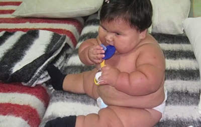 Колумбійська 10-місячна дівчинка важить як п ятирічна дитина