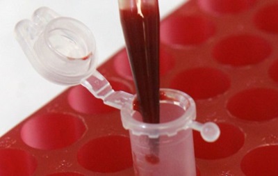 Аналіз крові може виявити рецидив раку