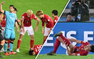 Китайский игрок получил двойной перелом ноги в матче с Барселоной