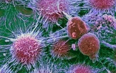 Вчені:  невезіння  мало впливає на рак
