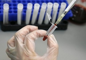 В Японии почти у двух тысяч человек были найдены признаки норовируса