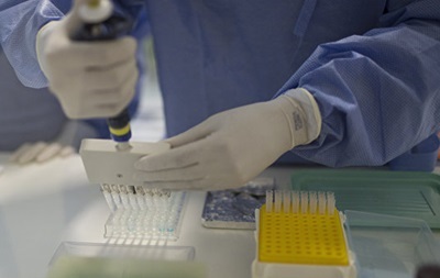 Чотири випадки захворювання вірусом Зіка зафіксовано у Великобританії