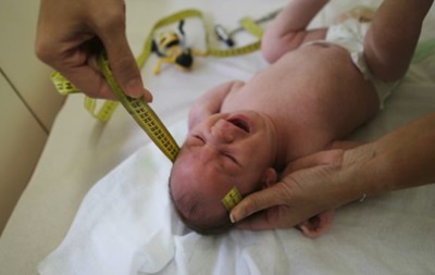 Вчені довели зв язок вірусу Зіка з мікроцефалією у новонароджених