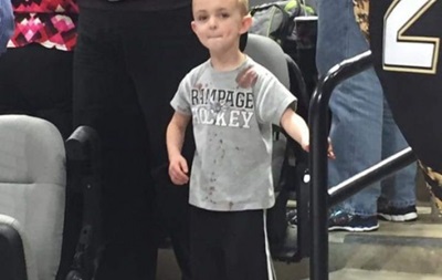 П ятирічний хлопчик після потрапляння шайби з лікарні повернувся на матч