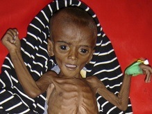 ВОЗ: Ежедневно голод уносит жизни 24 тысяч человек