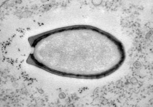 Новости науки: Ученые отнесли гигантские вирусы к новой форме жизни