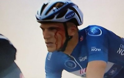 Украинский велосипедист разбил в кровь лицо сопернику
